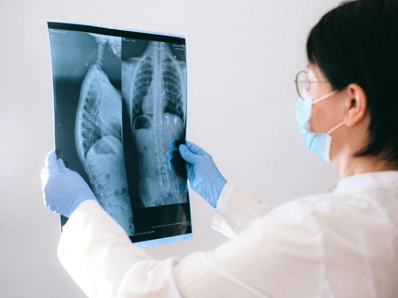 chest xray
