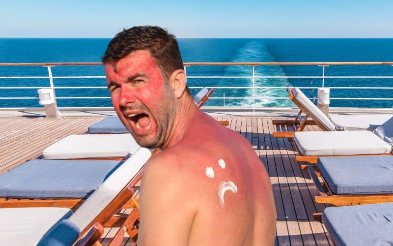 man with sunburn
